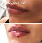 Центр косметологии Ivory отзывы